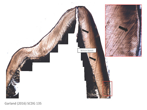 tooth